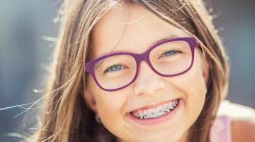 Preparing for Braces: A Parent's Simple Guide to Braces for Kids